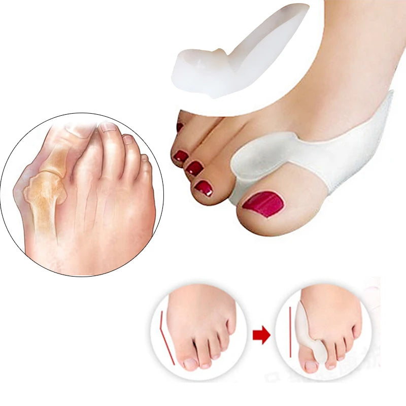 ToeSeparator | 1Paar Silicone Tenen Separator