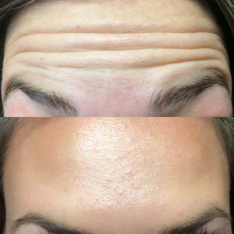 GlowLift | Het geheim van tijdloze schoonheid!