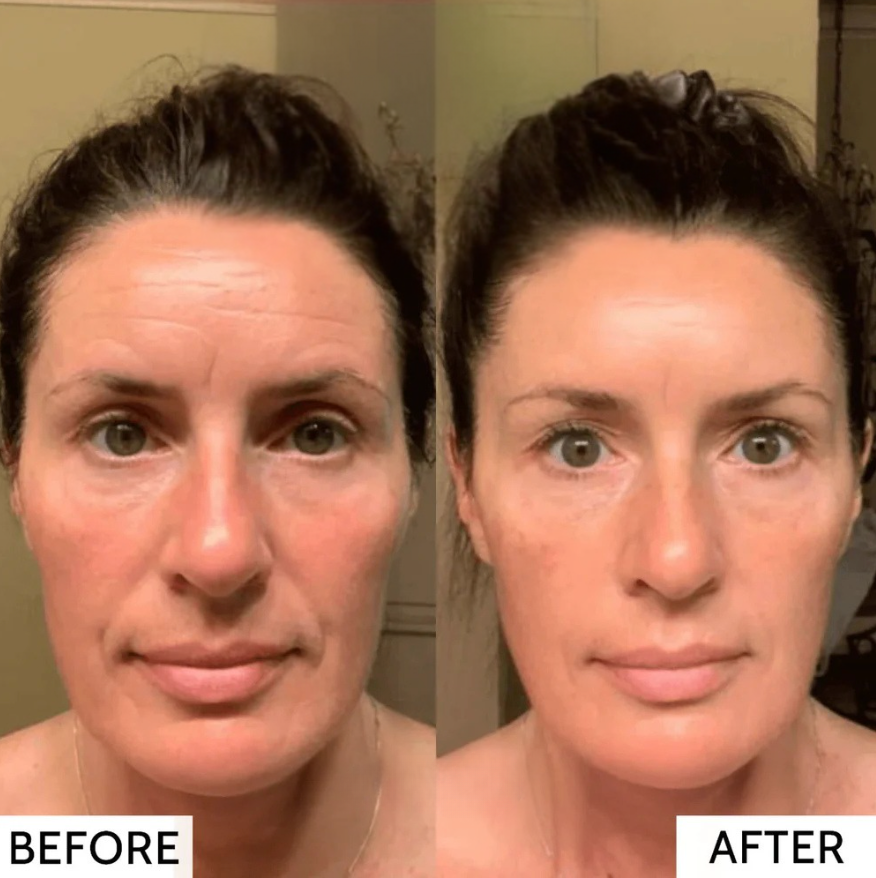 RevitaMask | Huid collageen masker