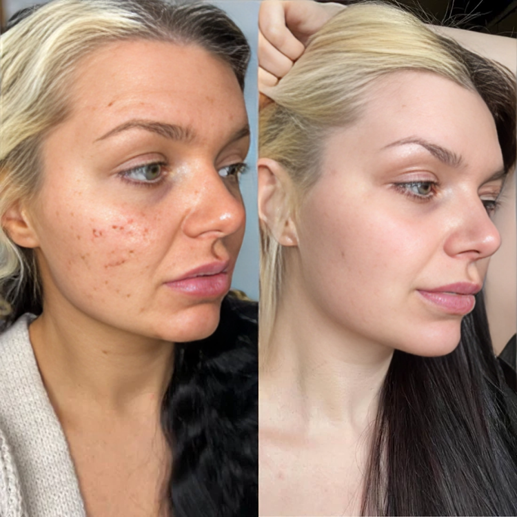 GlowLift | Het geheim van tijdloze schoonheid!