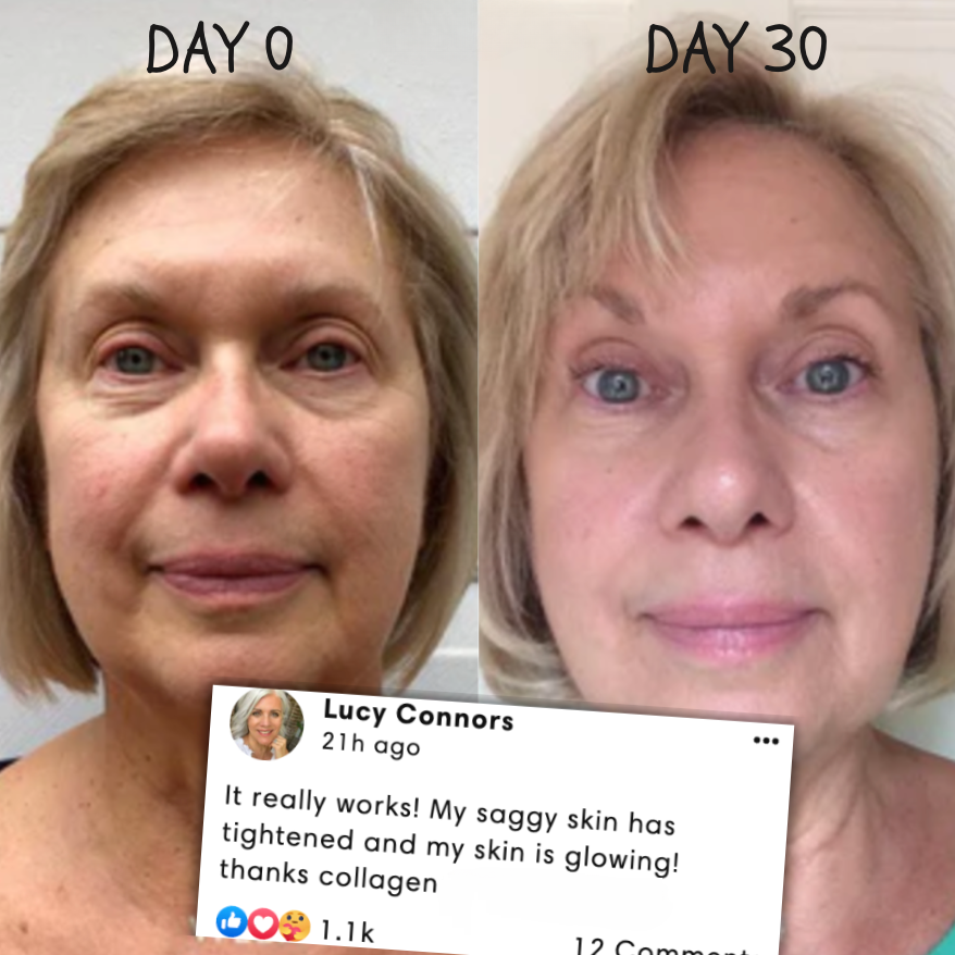 RevitaMask | Huid collageen masker