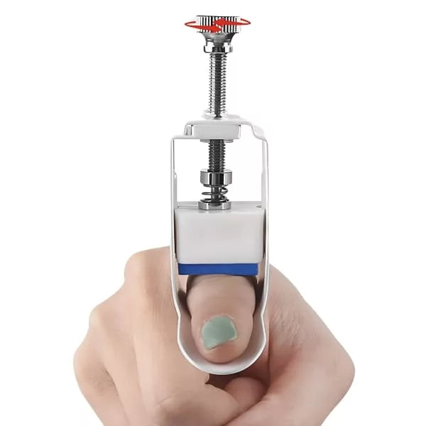 FlexiAlign | Precisie Vinger Herstel Spalk