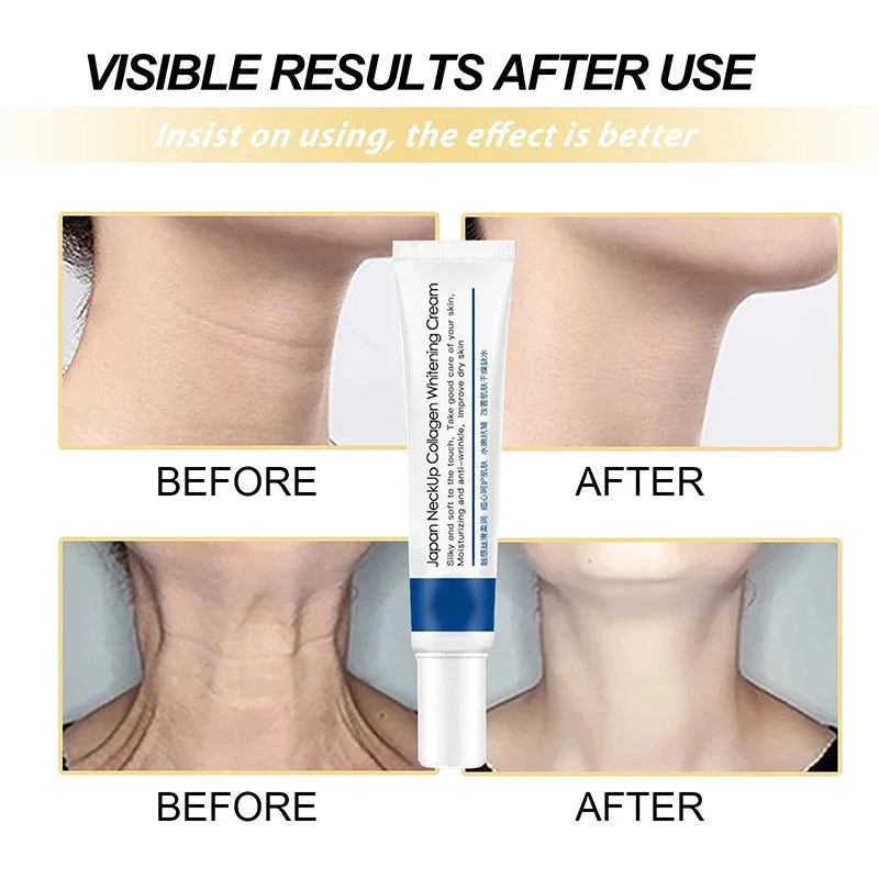 NeckRenew | Neklijnen elimineren - Verhelderende Moisturizer tegen veroudering