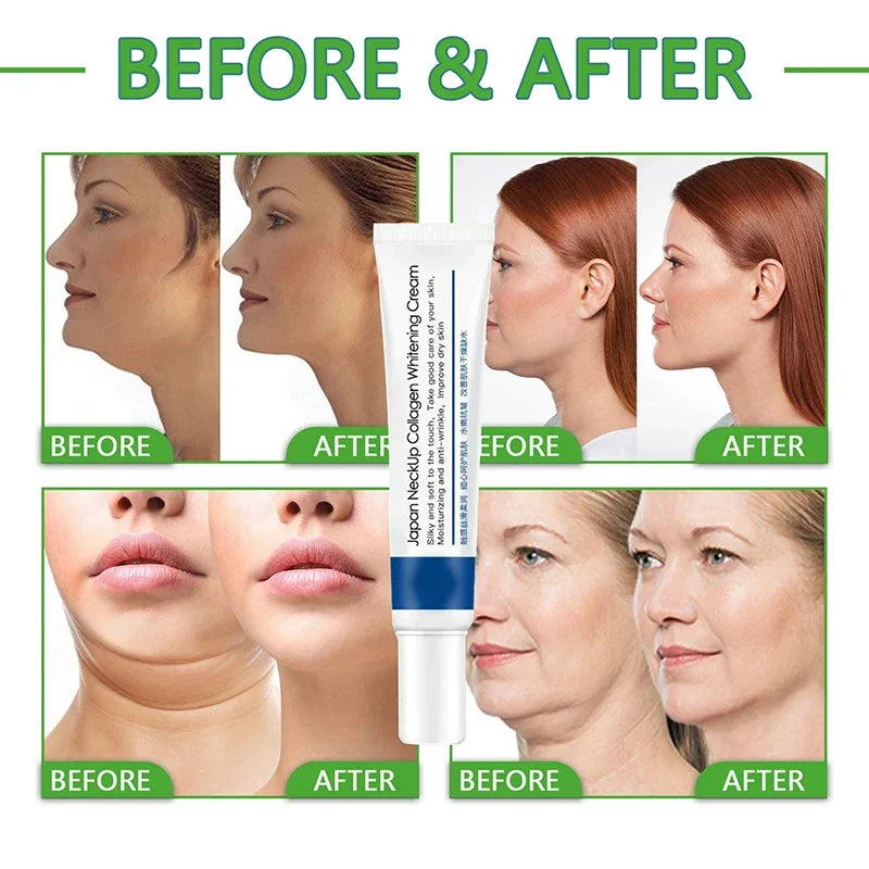 NeckRenew | Neklijnen elimineren - Verhelderende Moisturizer tegen veroudering