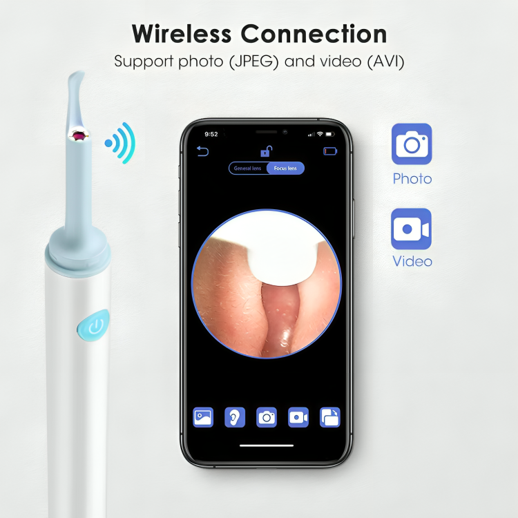 EarClear | Gemakkelijk oorsmeer verwijderen met realtime visuals!