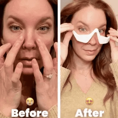 EyeBright Pro | Effectieve verwijderaar voor donkere kringen