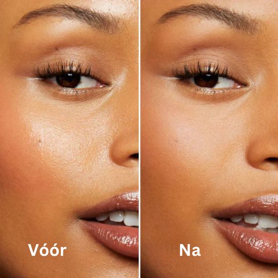 FreshFace | Olieabsorberende vulkanische rollen