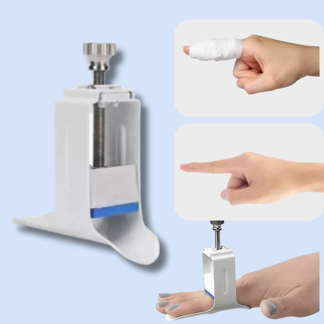 FlexiAlign | Precisie Vinger Herstel Spalk