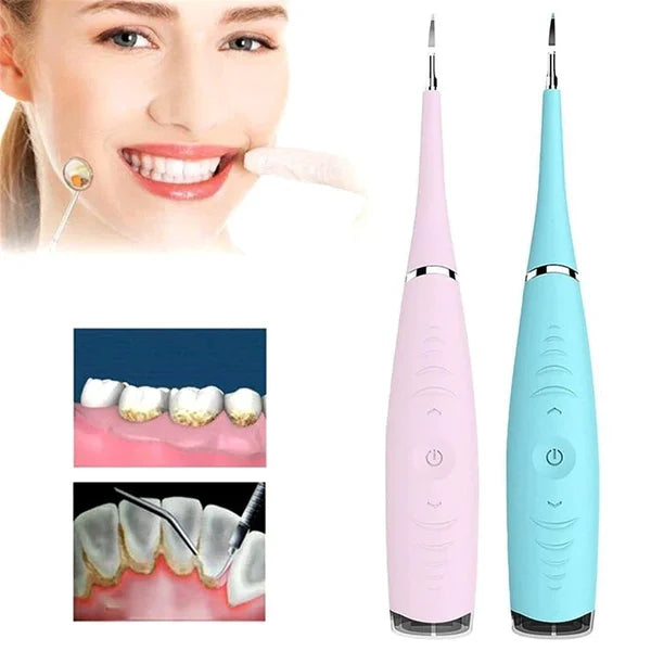 SonicSmile | Perfecte mondhygiëne in slechts 7 dagen
