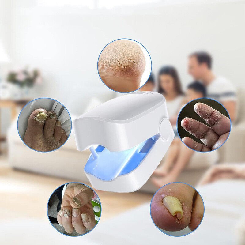 FungusVrij | Laser Nagel Device