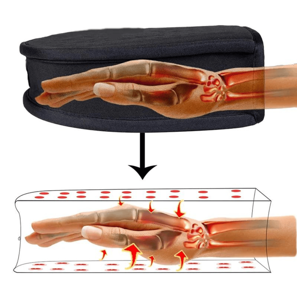 FlexiGlow | Lichttherapie Handschoen