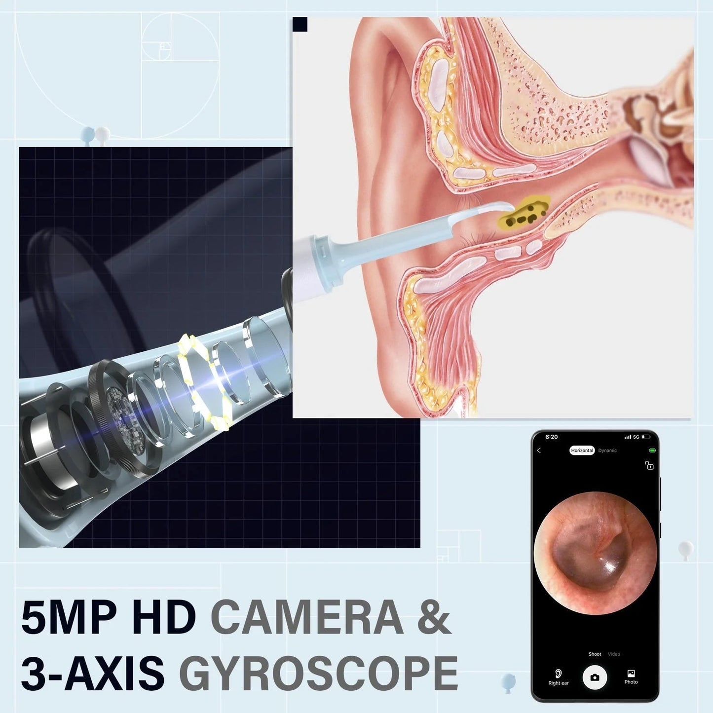 EarClear | Gemakkelijk oorsmeer verwijderen met realtime visuals!