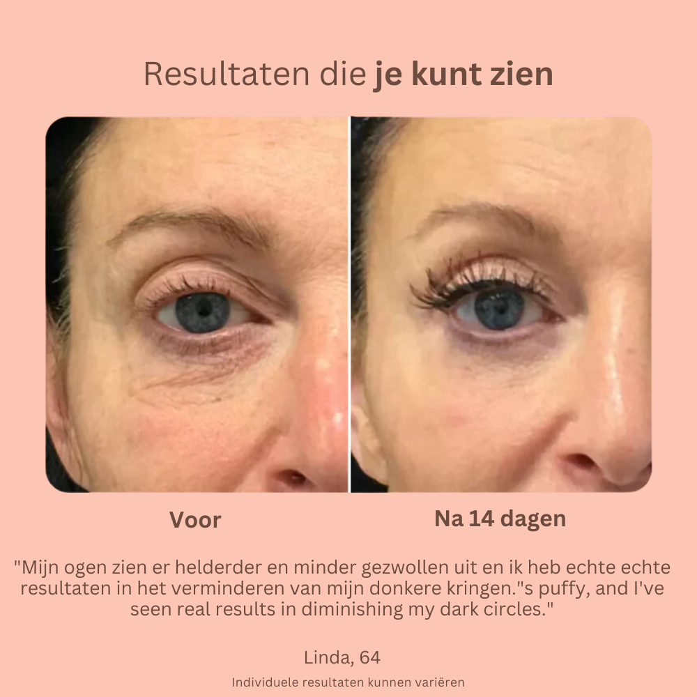 EyeBright Pro | Effectieve verwijderaar voor donkere kringen