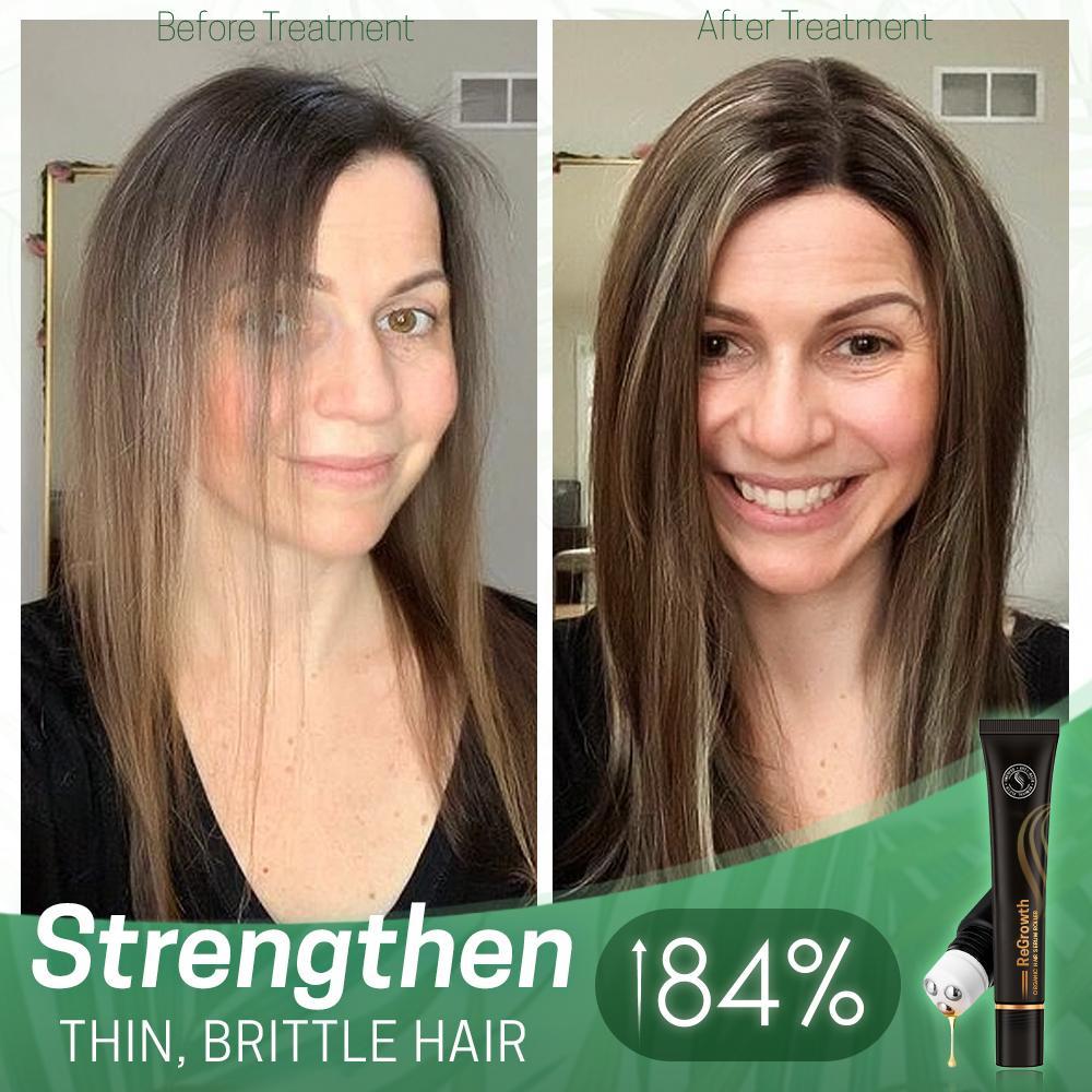 HairRevive | Herbal Hair Roller