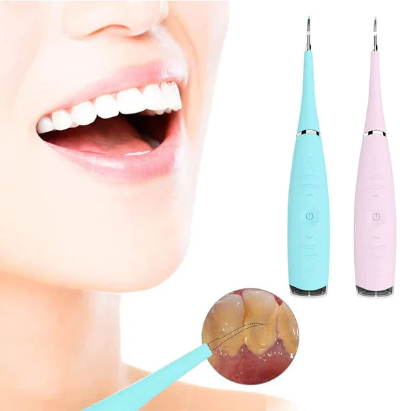SonicSmile | Perfecte mondhygiëne in slechts 7 dagen