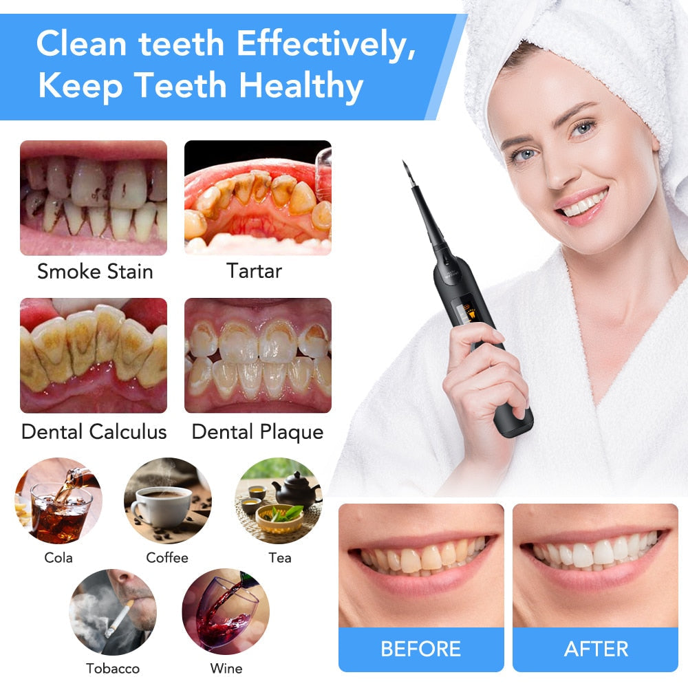 BrightSmile | Elektrische Plaque Flosser