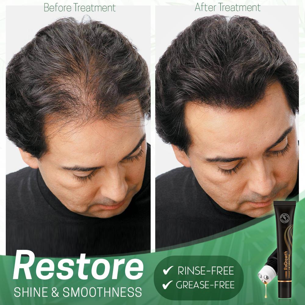 HairRevive | Herbal Hair Roller