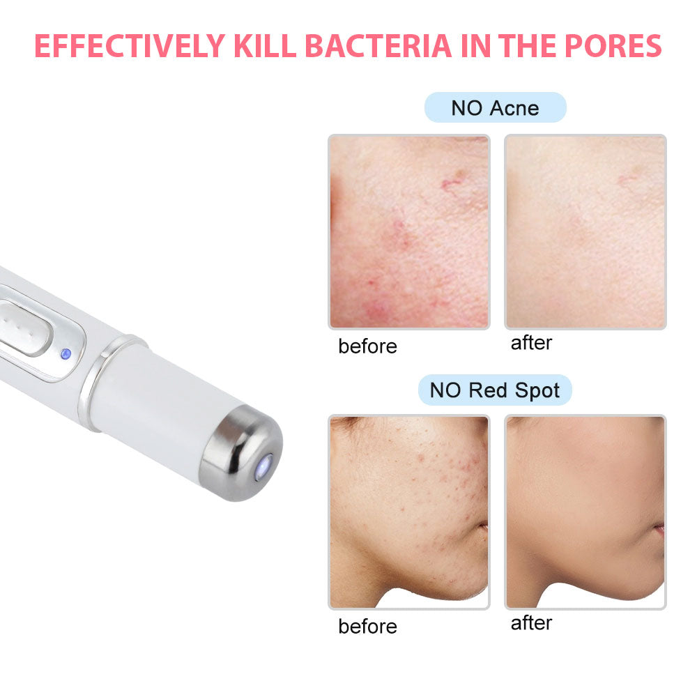 BlueGlow | Acne Pen