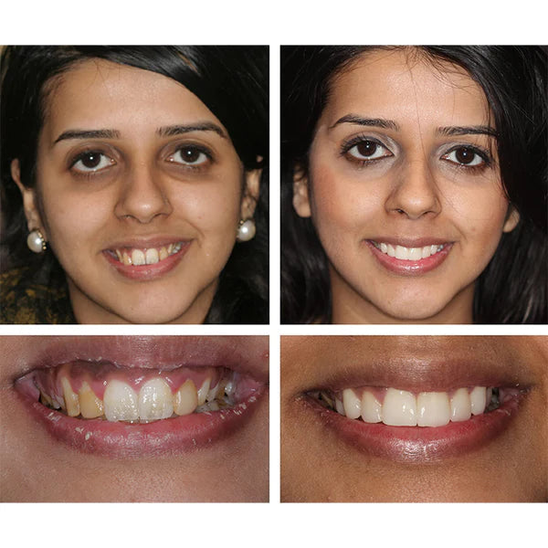 RadiantSmile | Stralende Glimlach Essentie