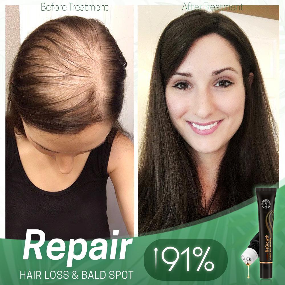 HairRevive | Herbal Hair Roller