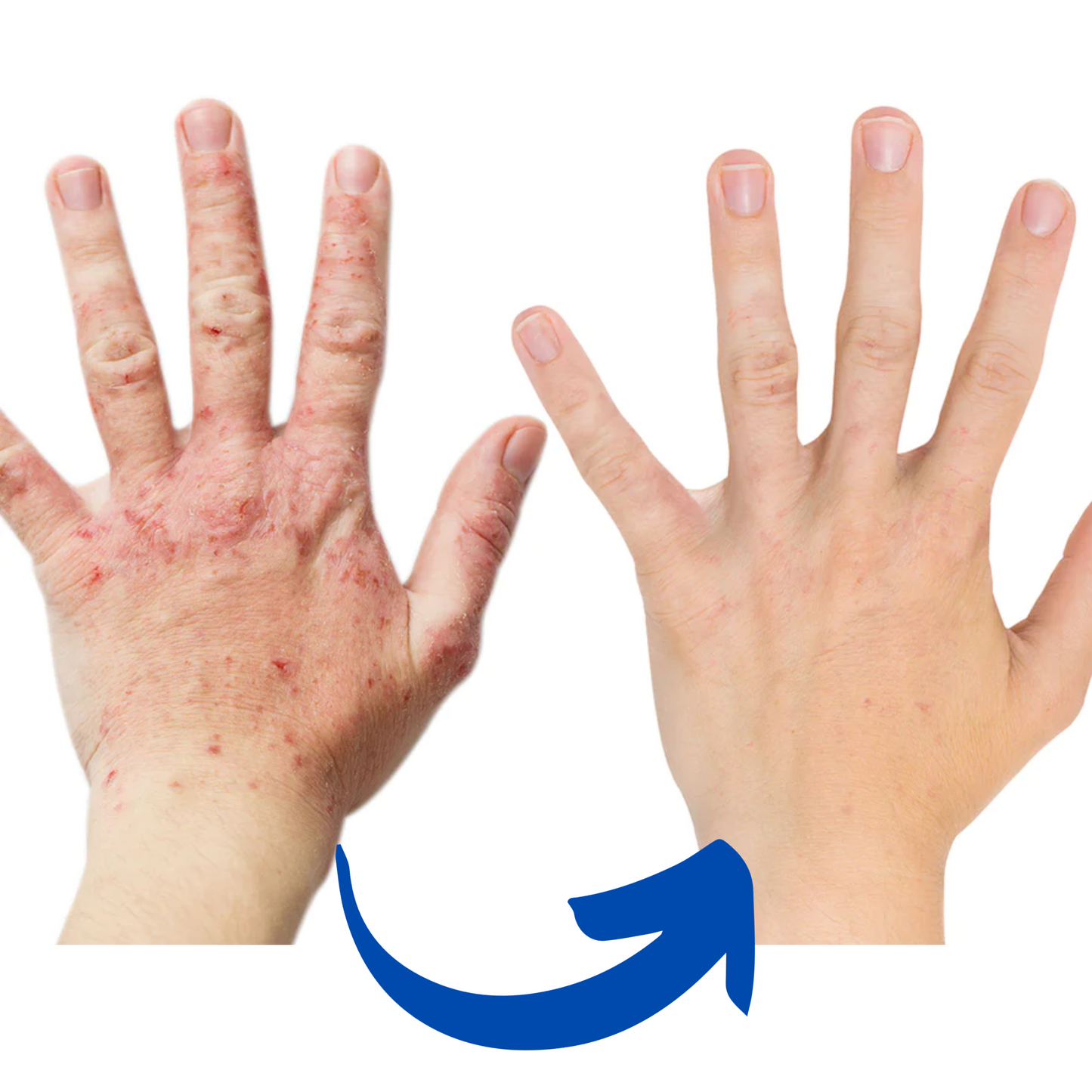 PainRelief Pro | Handlamp
