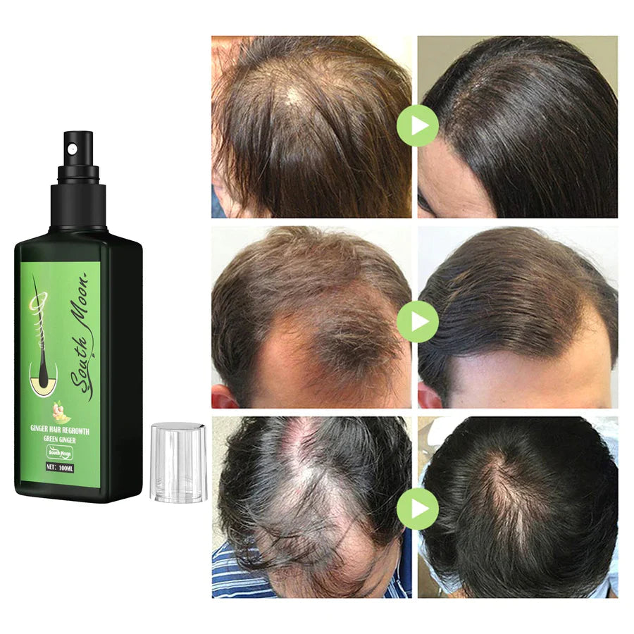FollicaBoost | Haarverdikkende Spray