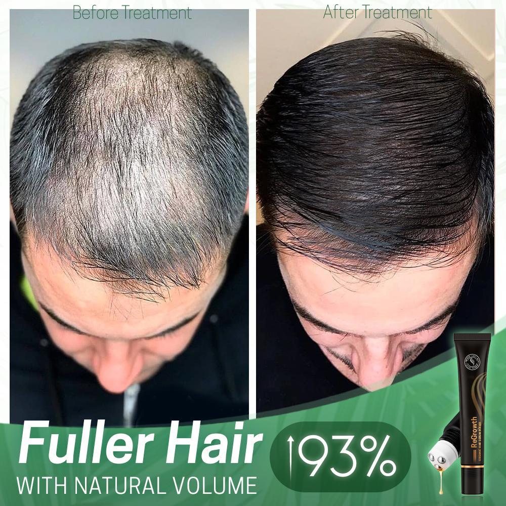 HairRevive | Herbal Hair Roller