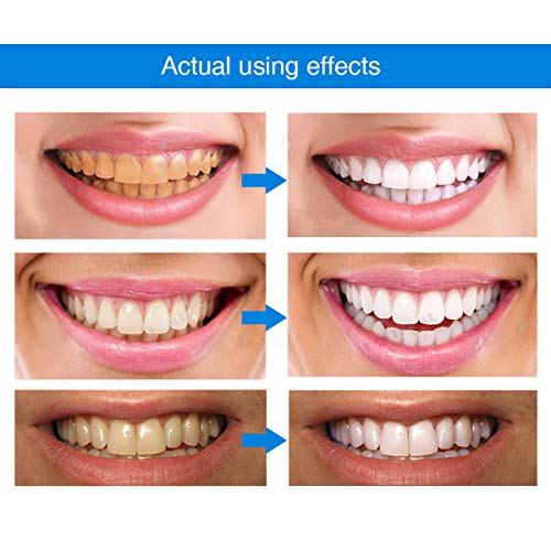 RadiantSmile | Stralende Glimlach Essentie