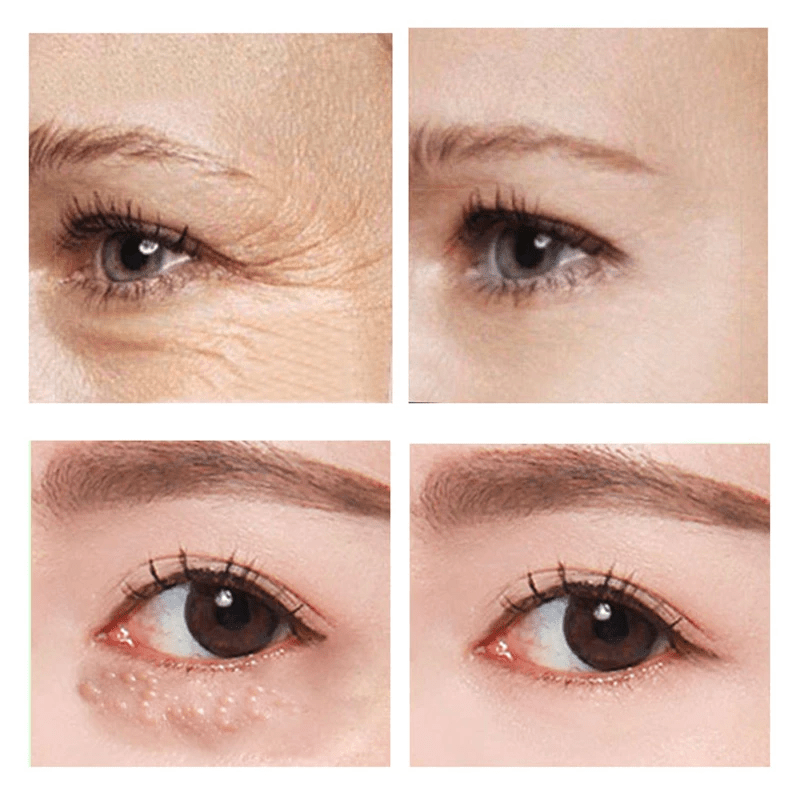 RevitaEyes | Jeugdige Oogcrème