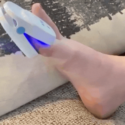 FungusVrij | Laser Nagel Device