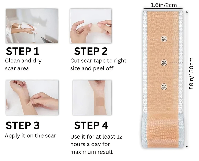 SkinMend | Silicone littekenvellen