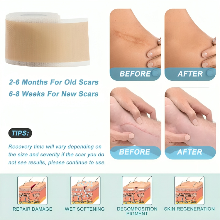 SkinMend | Silicone littekenvellen