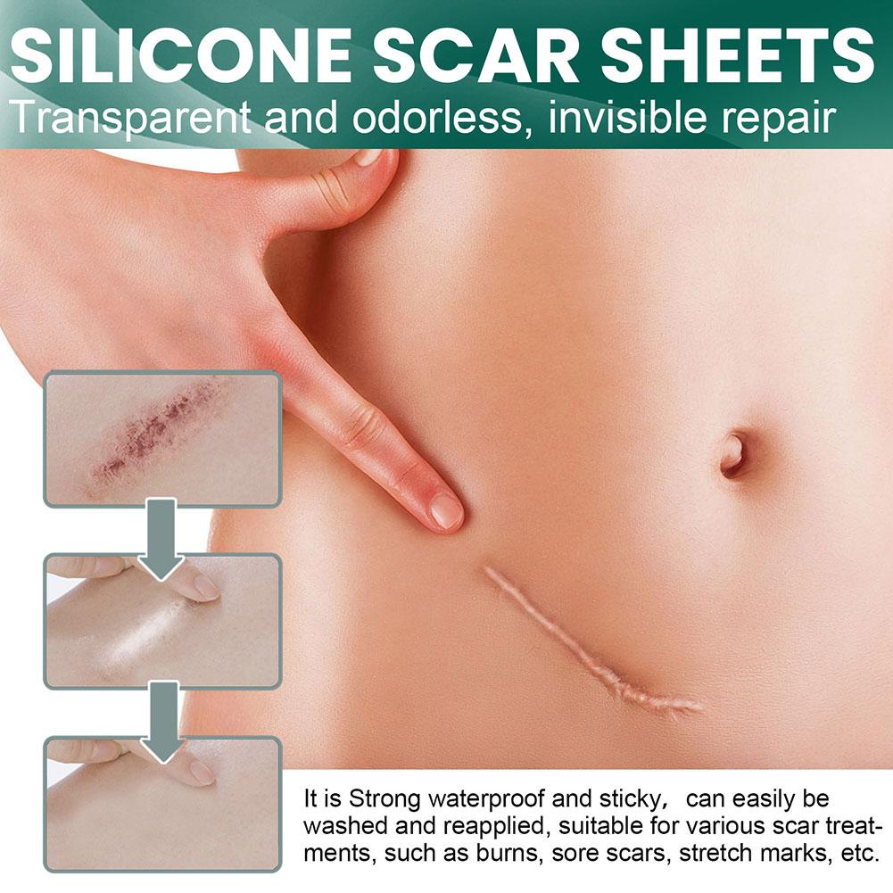 SkinMend | Silicone littekenvellen