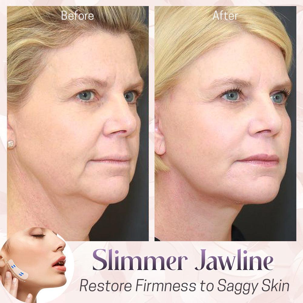 Invisible Face Lift Tape Kit - whambeauty