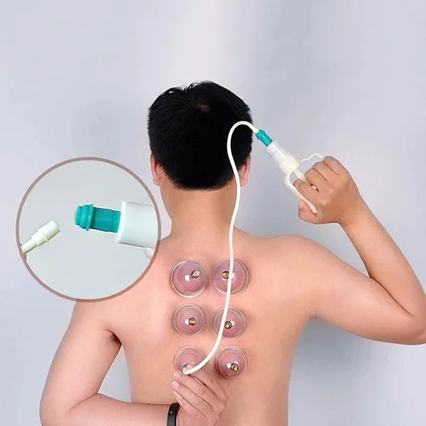 RejuvaCups | 32-kops Cupping-therapieset met pomppistool voor spierverlichting en ontgifting