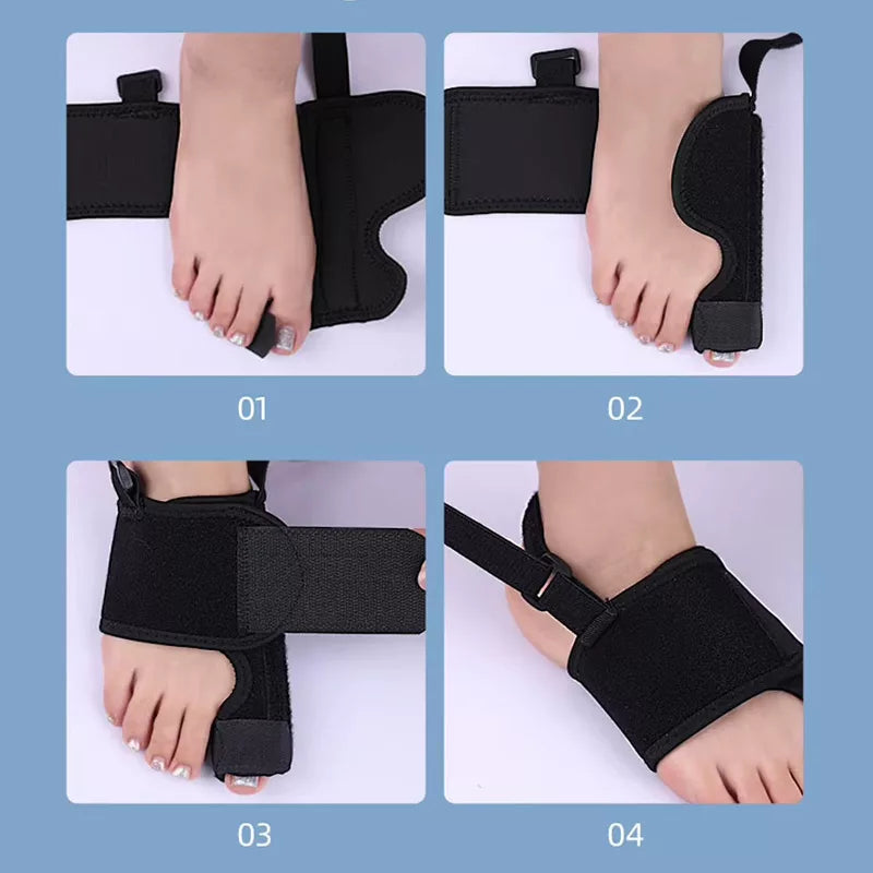 AlignaToe | Hallux Valgus Spalk