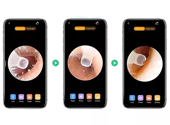 EchoScope | Smart EarCare visualisator