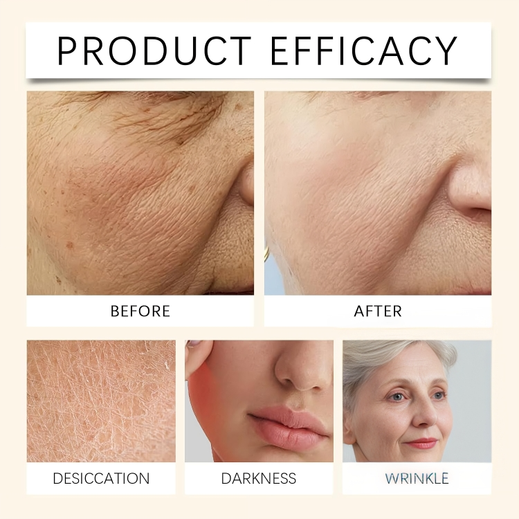 NouriSkin | Onthul het geheim van een zijdezachte huid van top tot teen!