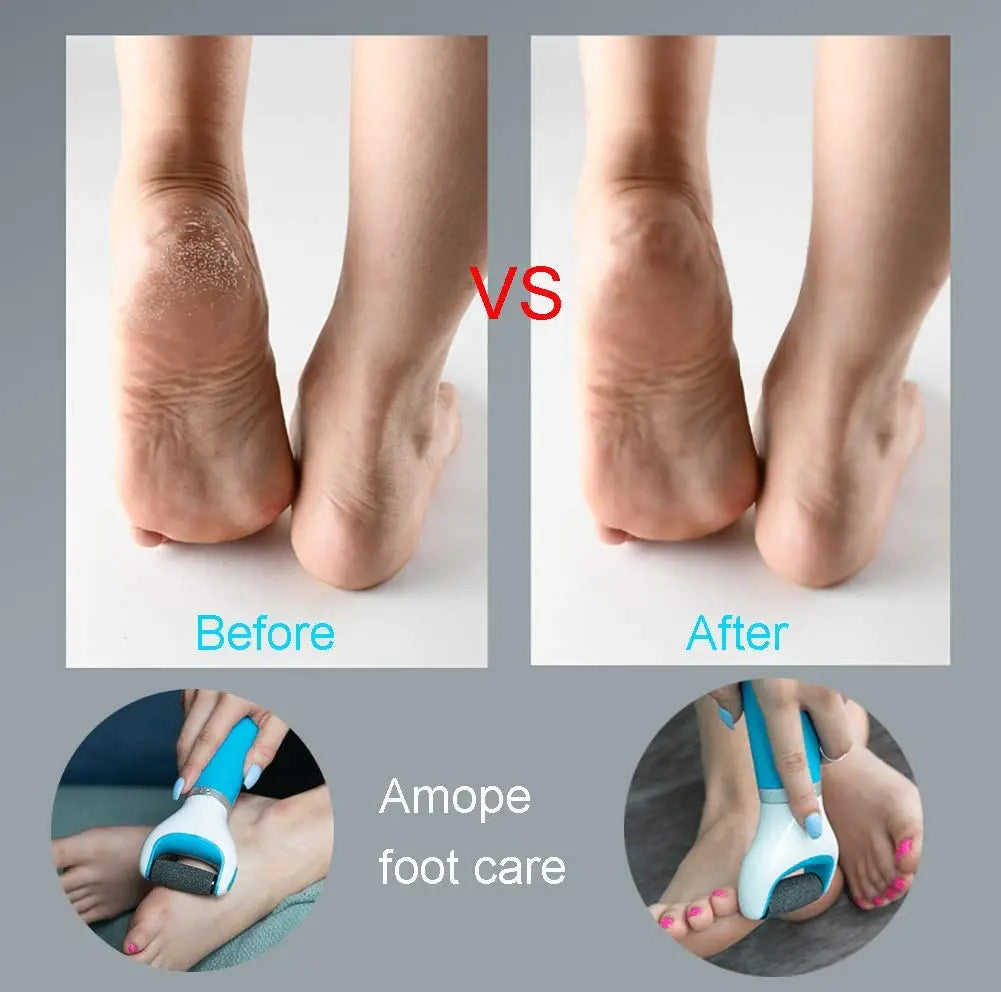 ElectricFootFile | Hulpmiddel voor voetverzorging