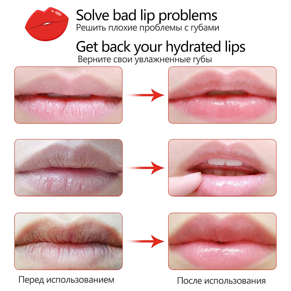 MoisturizingLipMask | Fruit Vitamine C Hydraterend Huidverzorgings Lip Masker