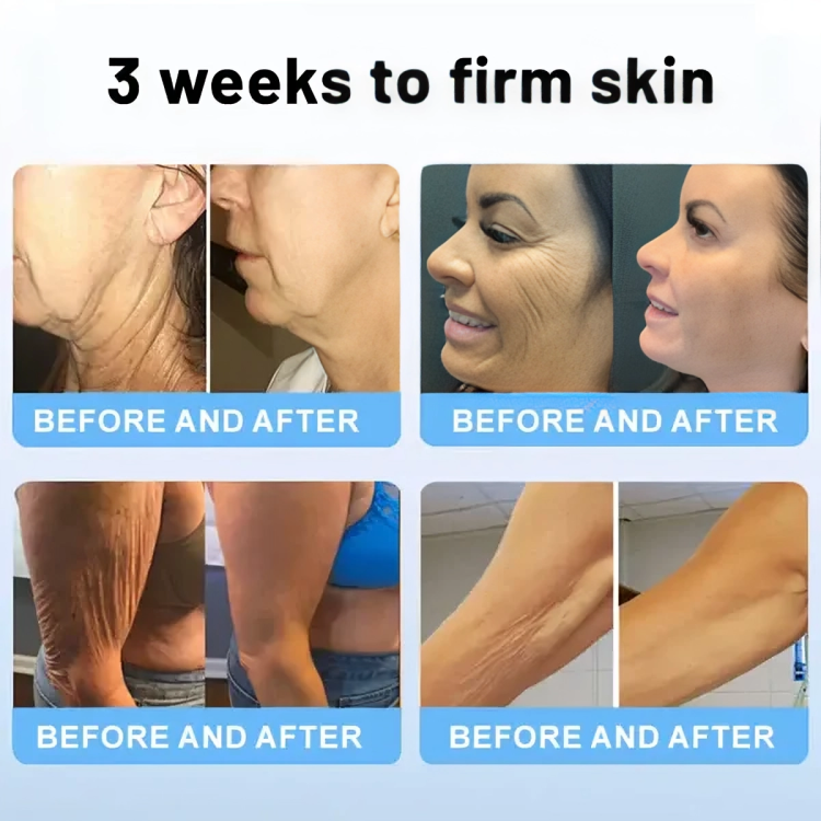 RevitaStick | Jouw geheim voor een stevigere, elastischere huid!