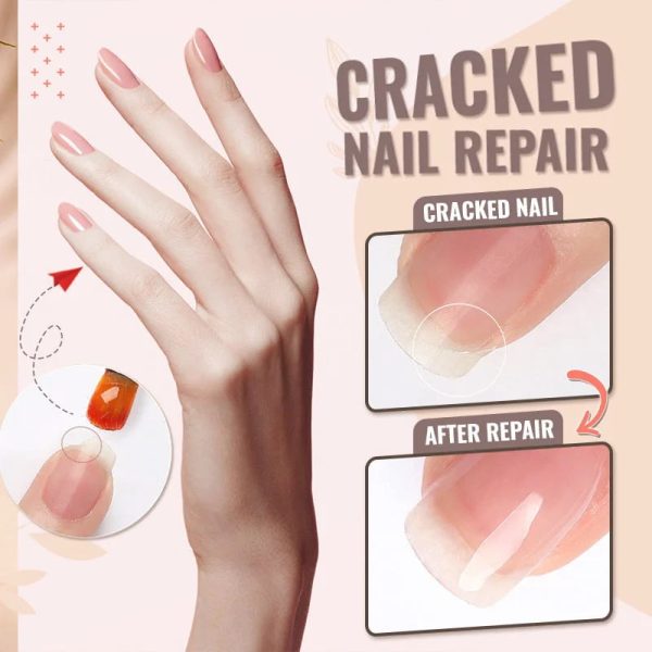 NailProtect | Jouw ultieme oplossing voor sterke, gezonde nagels