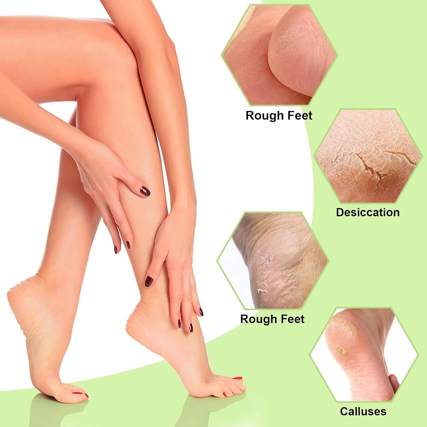 HydraFeet | Zeg maar dag tegen gebarsten hielen!