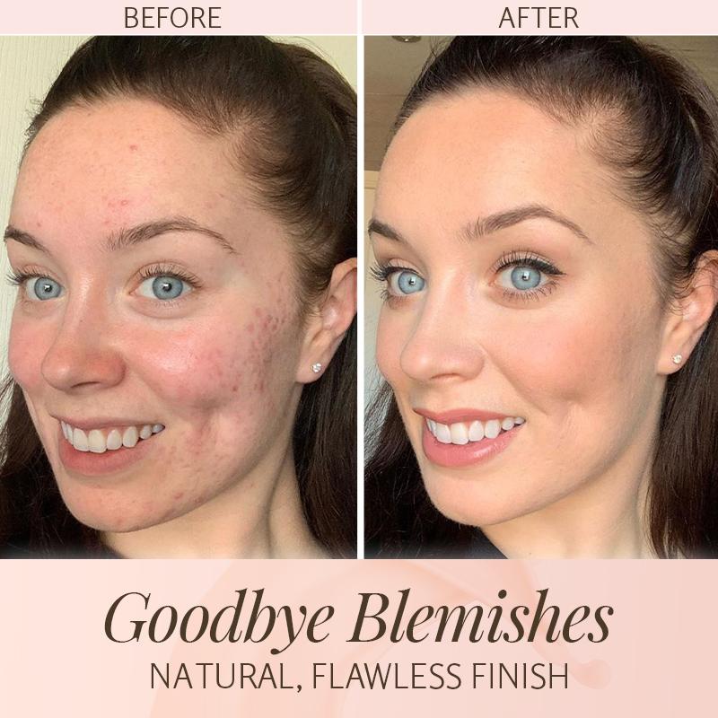 ByeBlemish Coverage Foundation - whambeauty