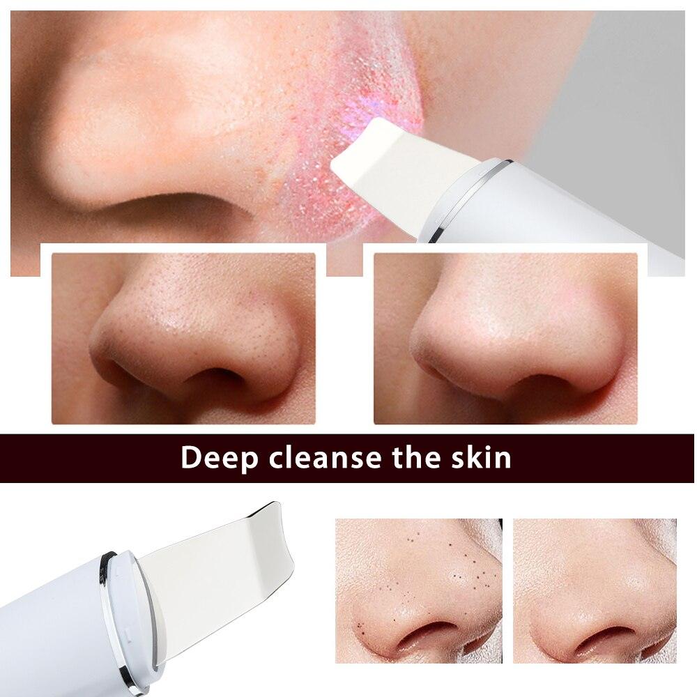 DermiClear - Ultrasone diepreinigende huidscrubber - whambeauty
