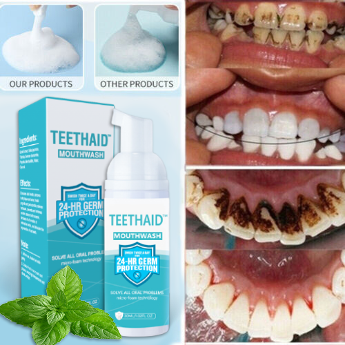 OralGuard - Puur plantaardige tandbleek- en mondverzorgingsmousse - whambeauty